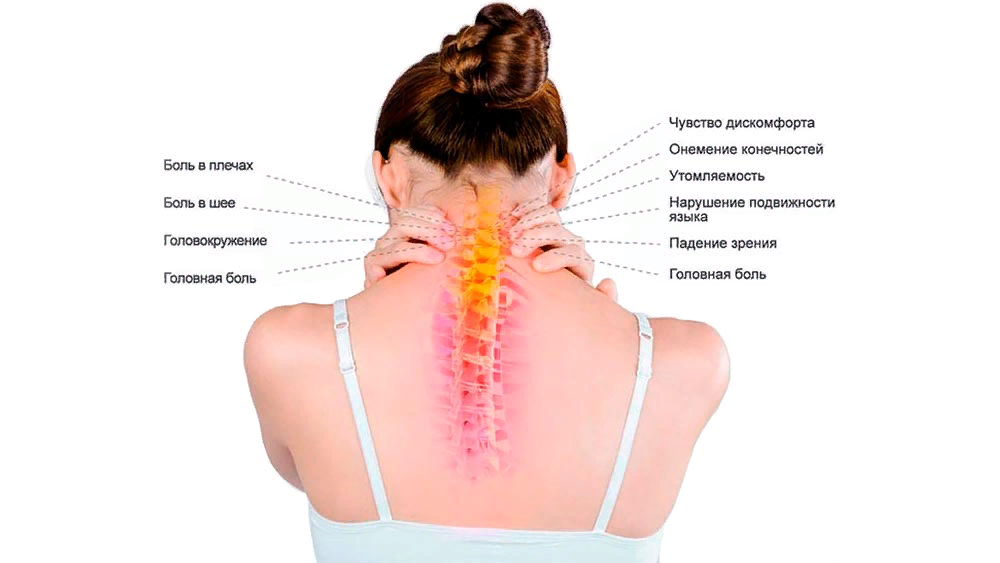 Слабость в шейном отделе позвоночника. Шейный остеохондроз. Дискомфорт в шейных позвонках.