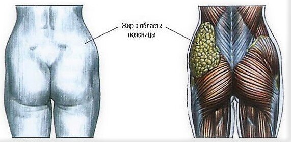 Неправильная техника выполнения упражнений