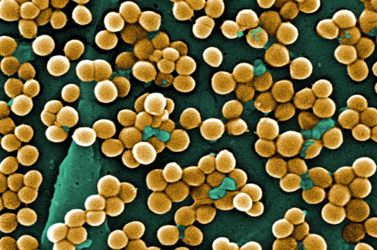 Strep infections in children that can result in 'flesh-eating' disease becoming 
