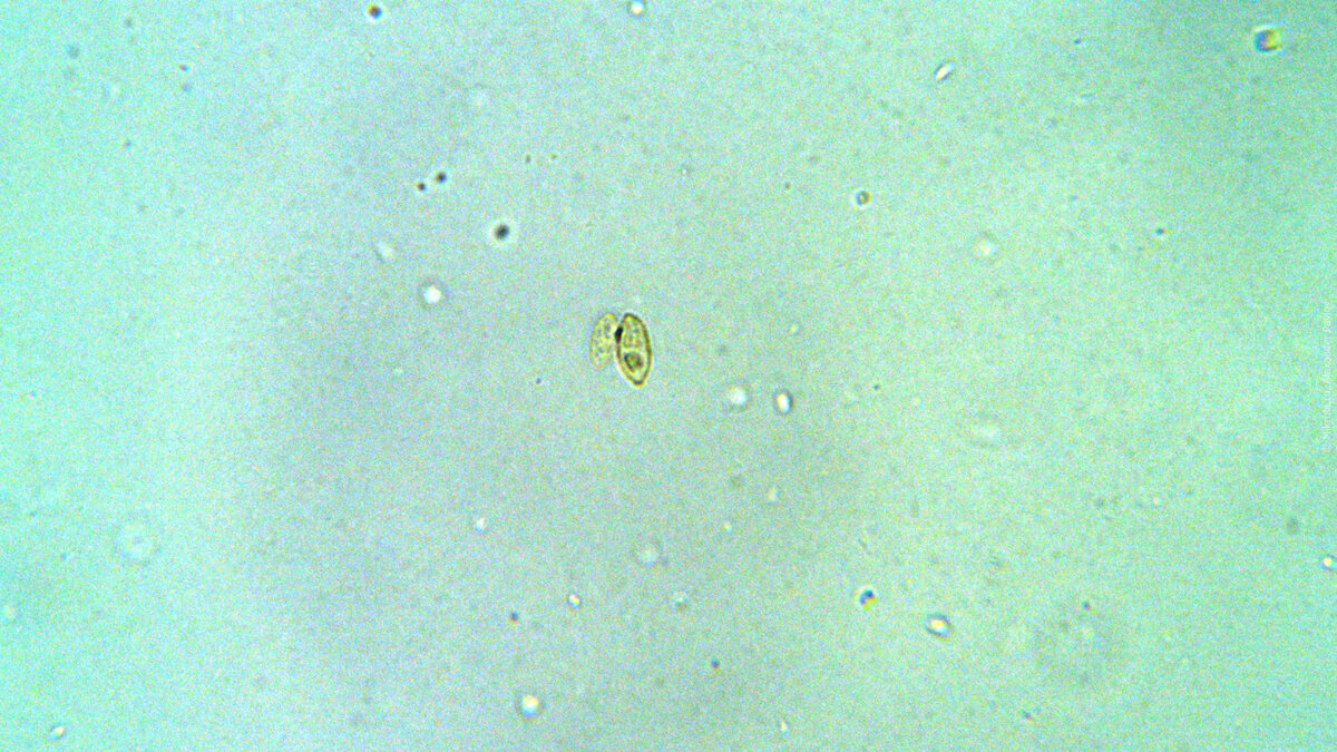 Мед под микроскопом картинки
