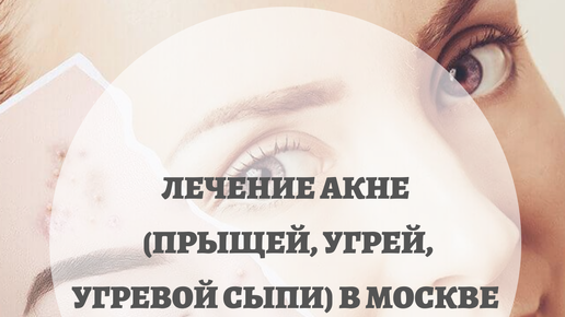 Отзывы о товаре «Противовоспалительная сыворотка для жирной кожи Cos De BAHA Niacinamide 10 Serum»