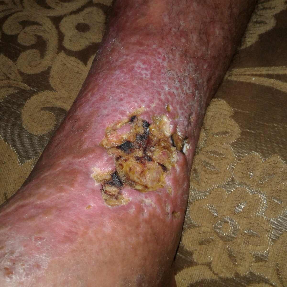                                                                 Декабрь 2018 года🧟