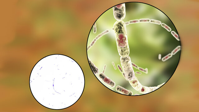 Возбудитель – Bacillus anthracis