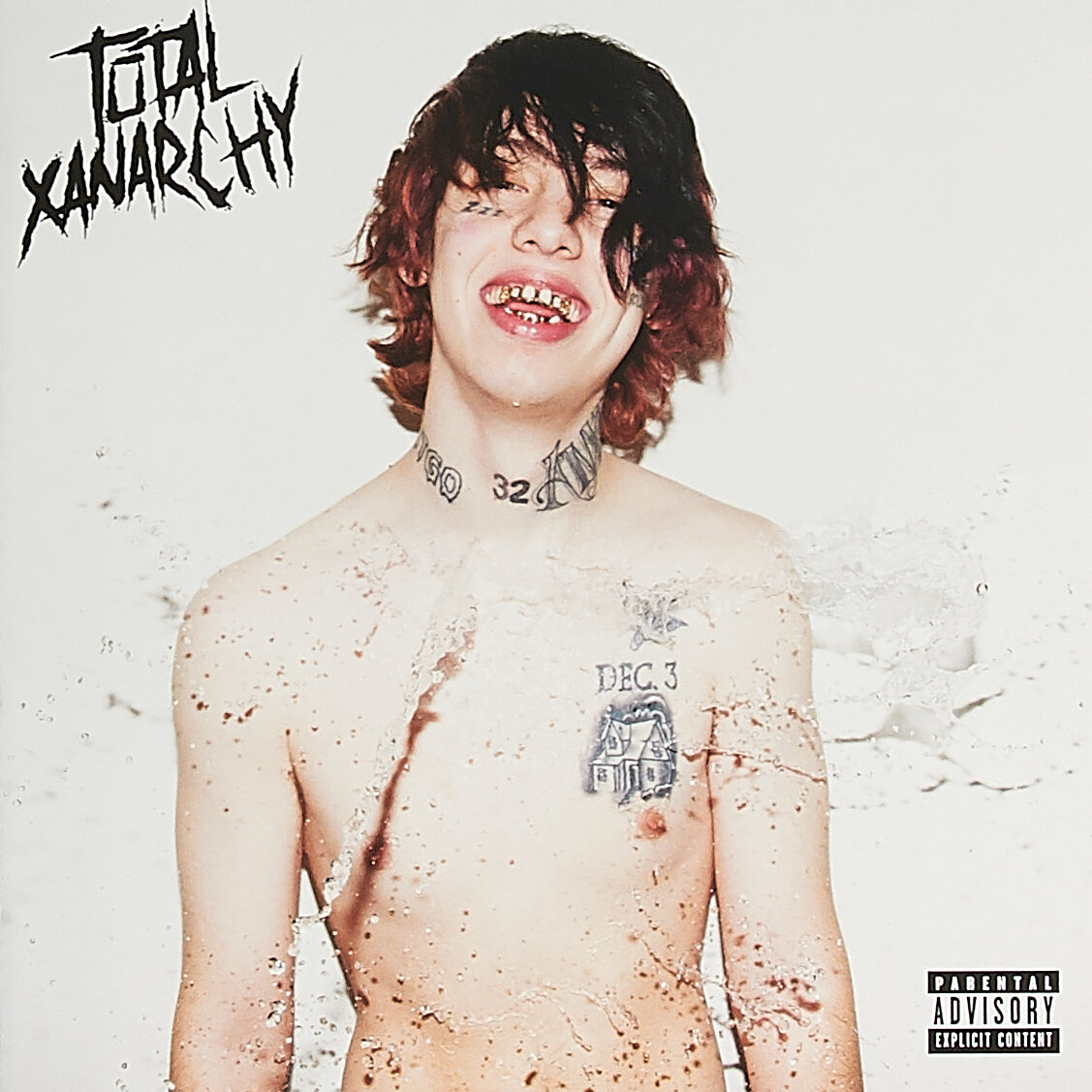 "TOTAL XANARCHY"