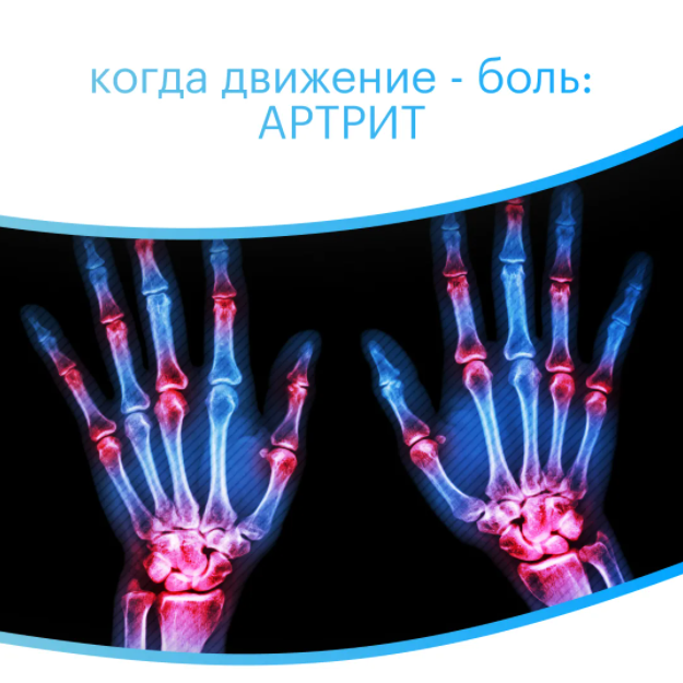 Изображение взято из Яндекс.Картинки