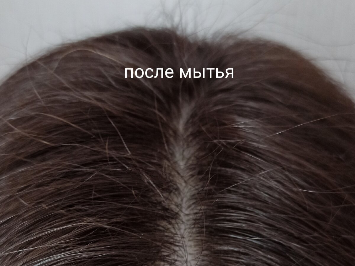 Волосы до мытья 