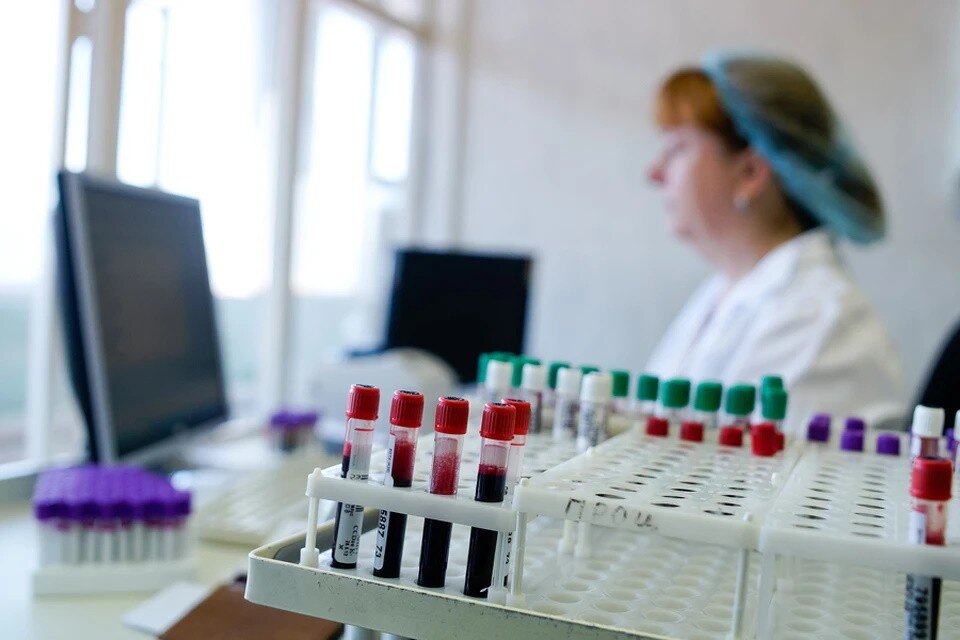     При высоком содержании сахара в крови страдают сосуды и ухудшается зрение Алексей БУЛАТОВ