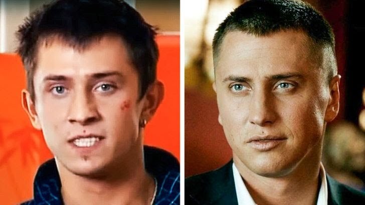 Операция прилучного на уши фото