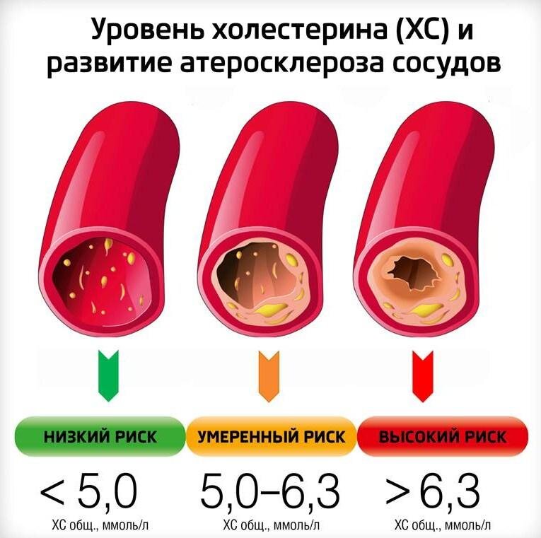 Холестерин – это органическое соединение в виде липофильного спирта, который содержится в клеточных мембранах. Он отсутствует в прокариотах, растениях и грибах. Его главная функция заключается в поддержании стабильности структуры стенок клеток и обеспечении их проницаемости. Вещество необходимо для биосинтеза: