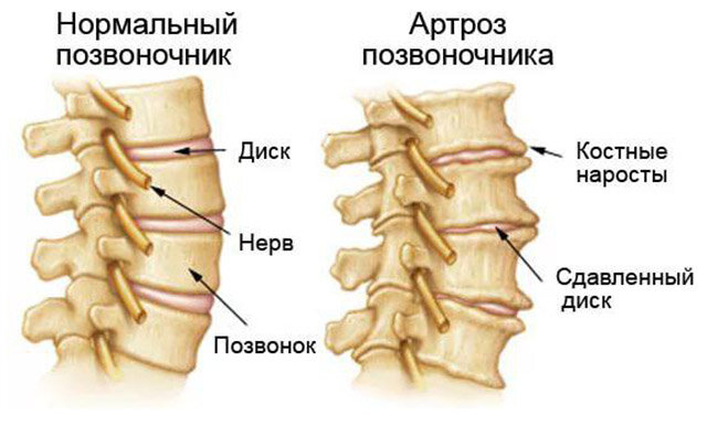 Болит спина