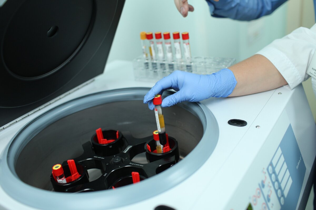 Кому прямо сильно интересно - выглядит это примерно так. Кровь помещают в стеклянный капилляр, разделенный на 100 делений, и далее центрифугируют. Это позволяет разделить субстанцию на жидкую (в верхней части) и нерастворенную (осевшую под своей тяжестью эритроцитарную массу в нижней части пробирки), а также определить их процент в общем объеме.