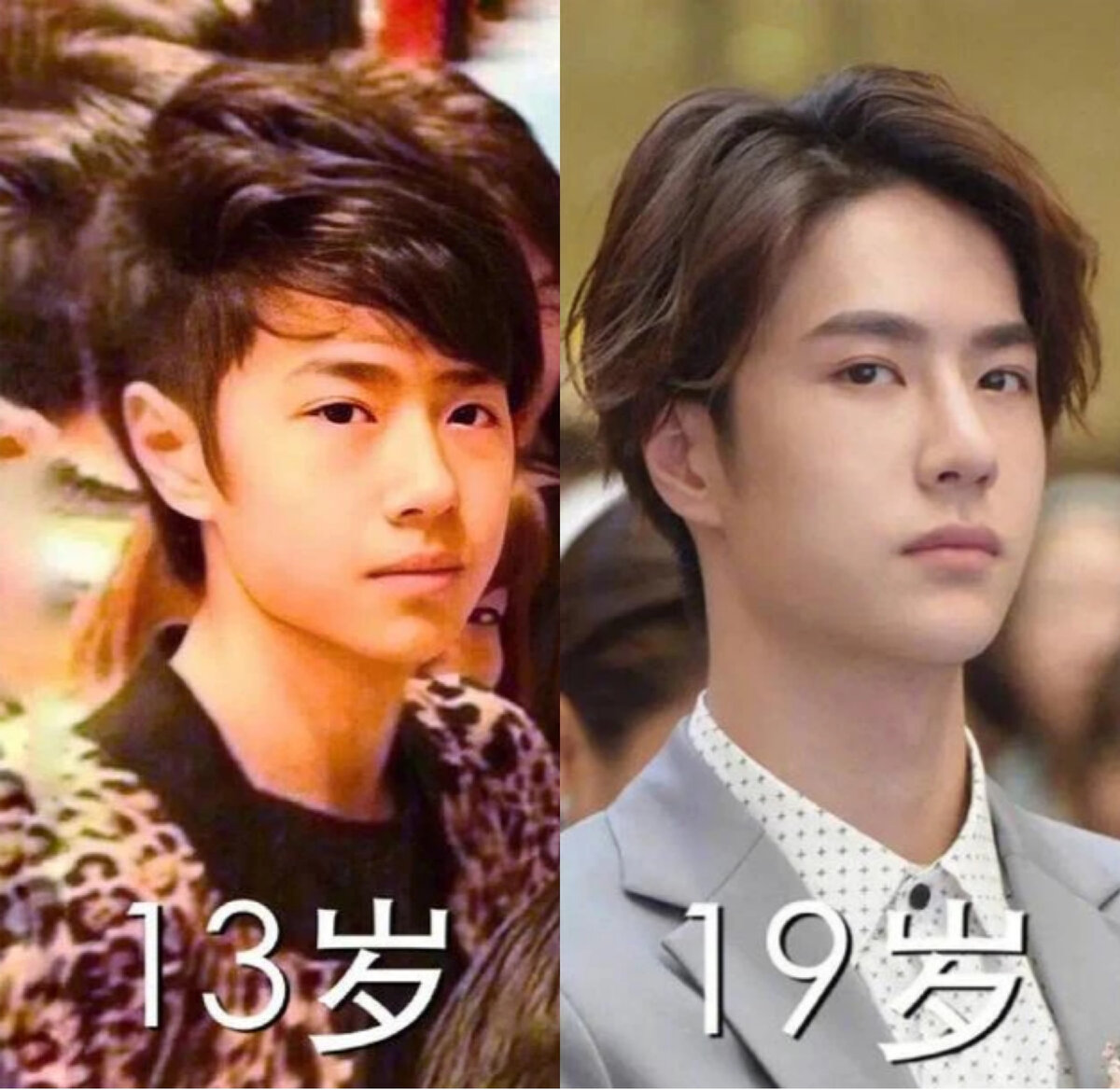 Вообще никакой разницы. Уж если делать пластику, то как-то позаметнее, что ли, иначе в чем смысл? 😊