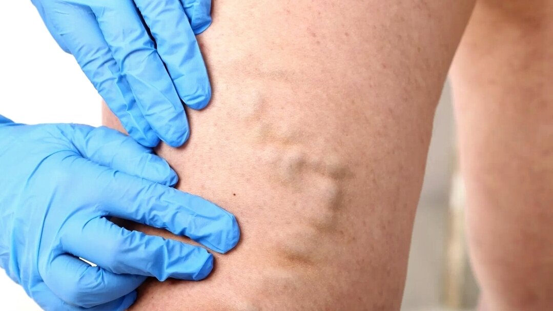 Помимо всего прочего, они ещё и болят 