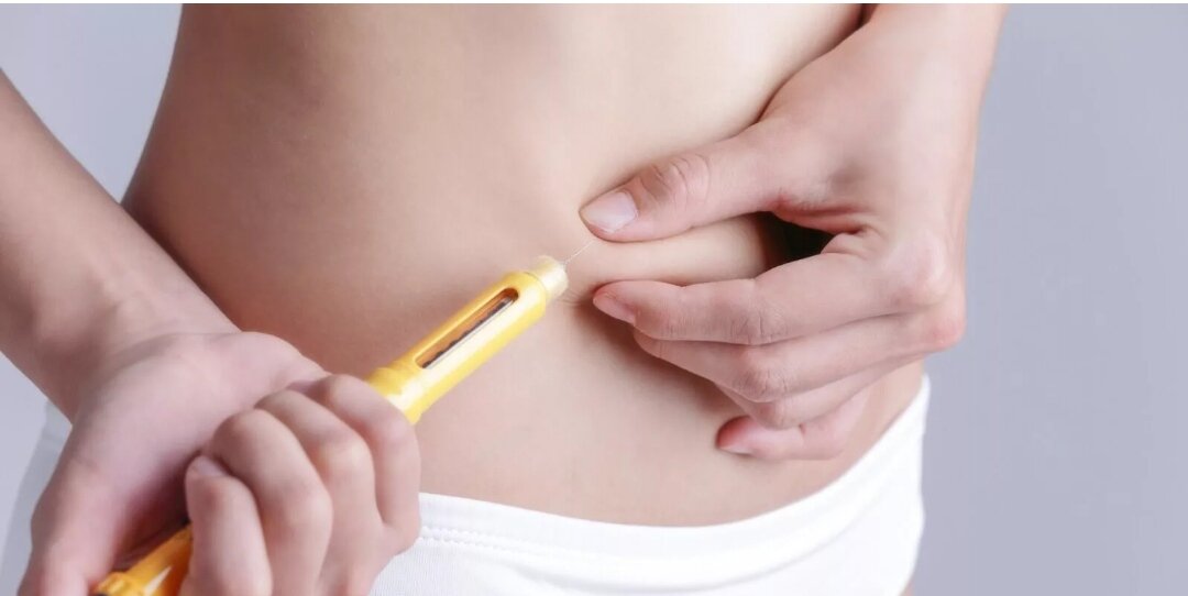 Фото из Интернет