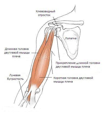 Дистальное сухожилие двуглавой мышцы. Тендинит дистального сухожилия бицепса. Разрыв сухожилия двуглавой мышцы.