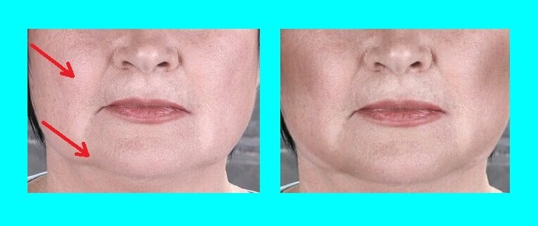 На фото видно, что брыли нетронуты скульптором, они выглядят светлее. Так и должно быть