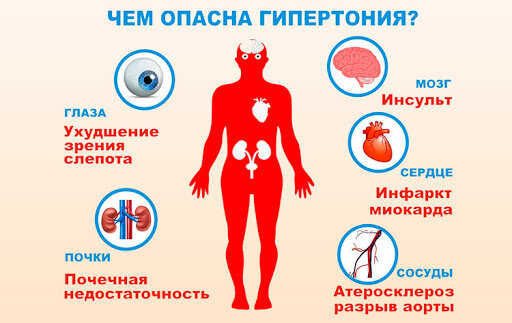 Симптоматические проявления гипертонической болезни