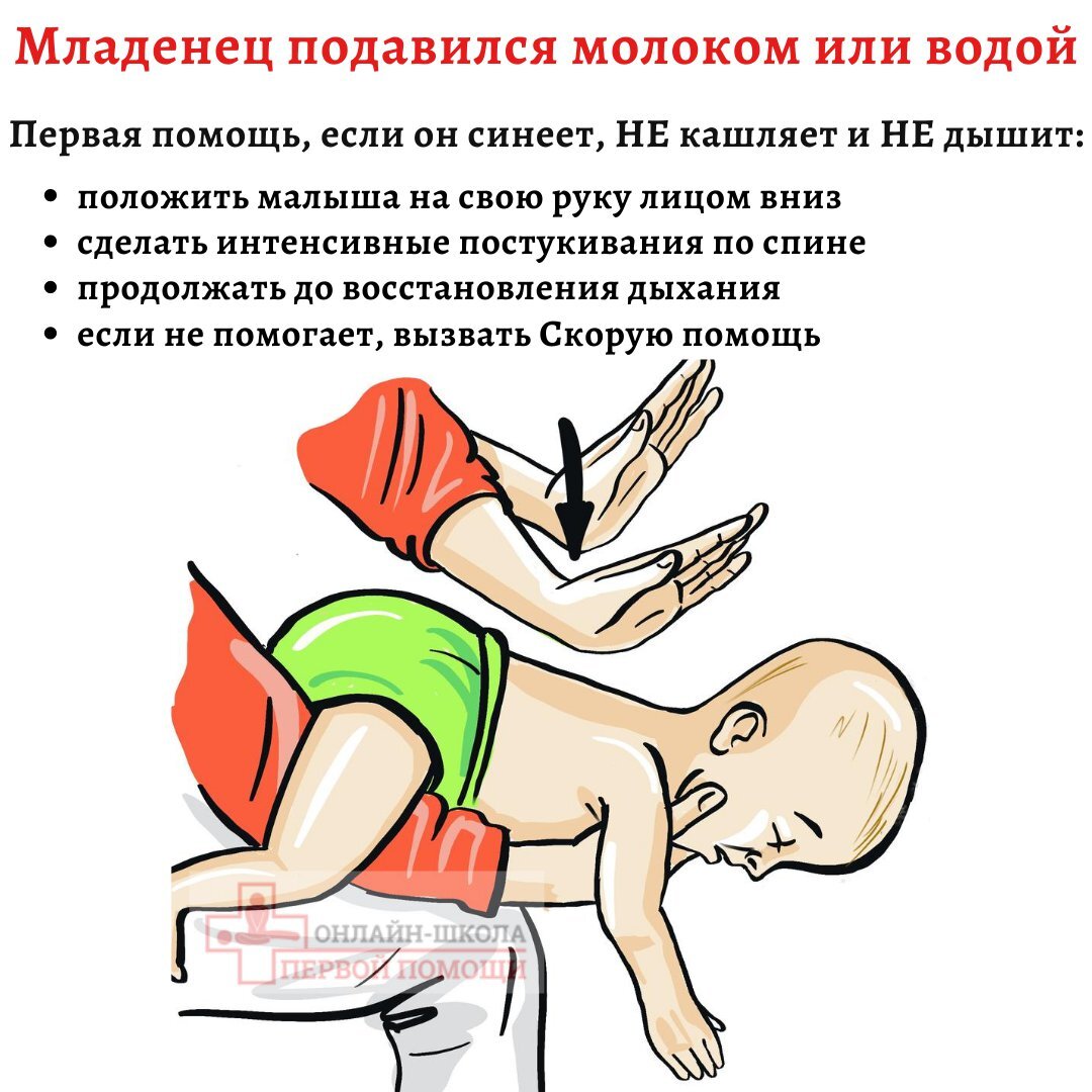 Первая помощь ребенку, который подавился или поперхнулся