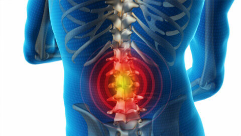 Грыжа позвоночника