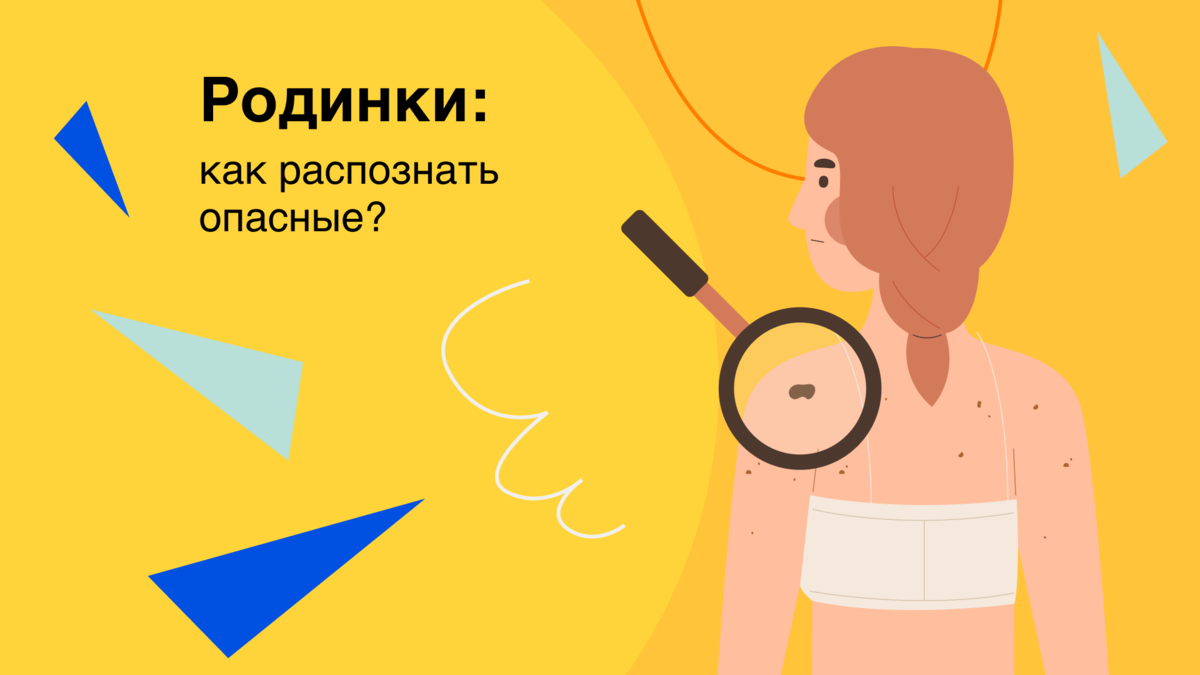 Родинки: как распознать опасные и вовремя принять меры? | Здоровый подход |  Современная медицина | Дзен