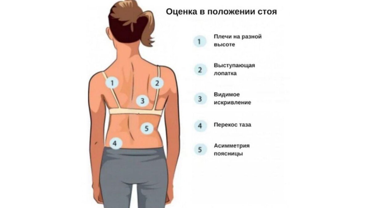 Оценка положения