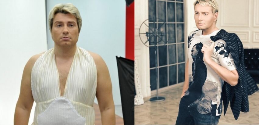 Басков до и после пластики
