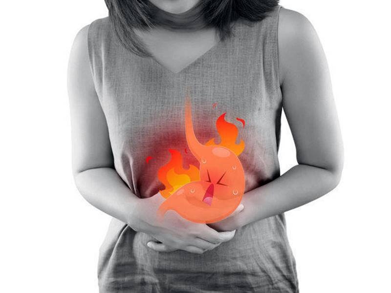 Изжога - это жжение за грудиной, распространяющееся снизу вверх 