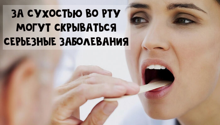 Как устранить сухость во рту и почему она возникает | Colgate®