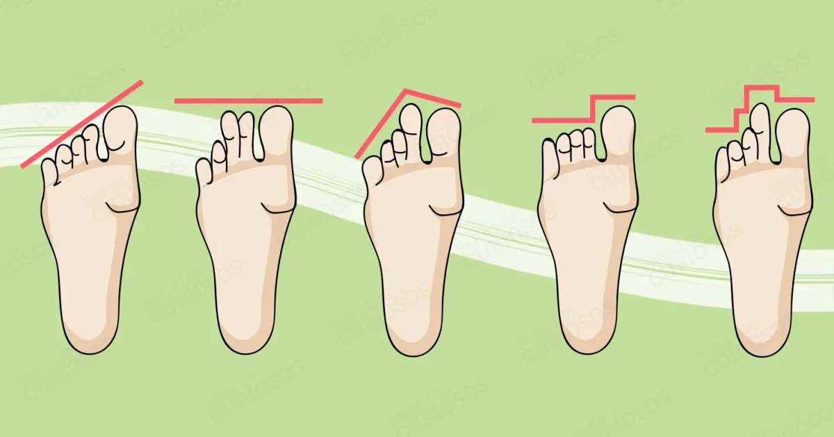 Виды стоп ног по пальцам. Разновидности пальцев на ногах. Идеальная форма пальцев на ногах. Форма расположения пальцев на ногах. Форма пальцев стопы.