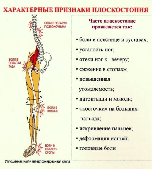 Боль в голеностопном суставе: что делать, куда обратиться за помощью? - Центр доктора Бубновского