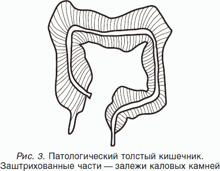 Иллюстрация из книги Г. Малахова "Целительные силы"