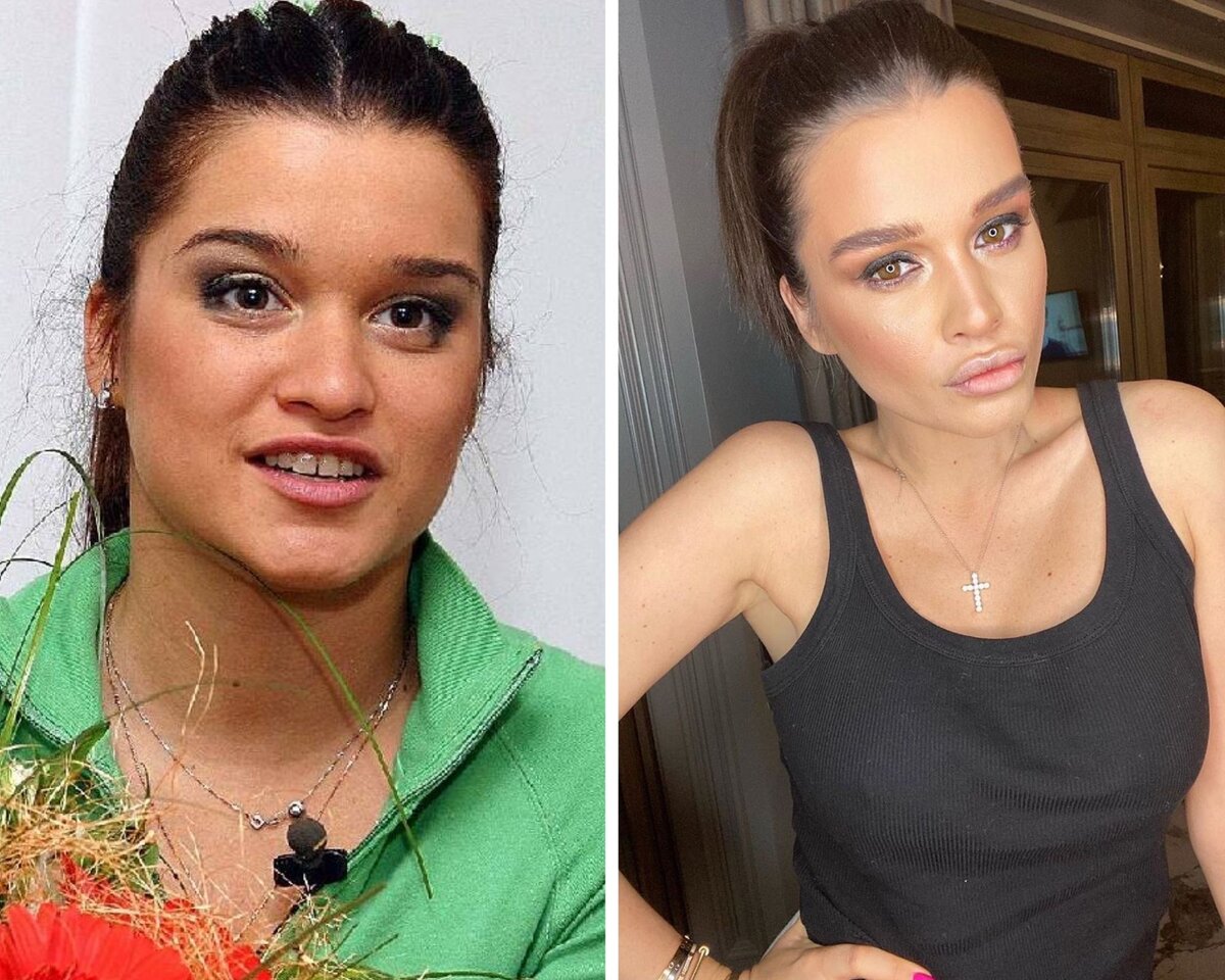 Конечно же, мы верим, что никаких операций Ксения не делала... Всё ненужное само рассосалось и отвалилось чудесным образом.