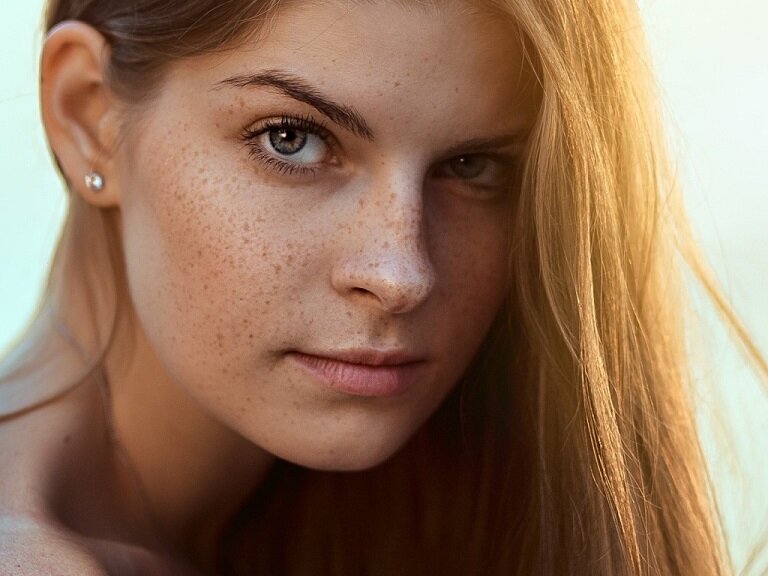 веснушки - это тоже пигментные пятна