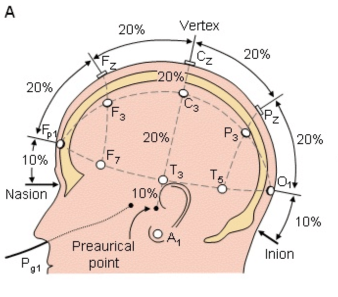 10 20 ЭЭГ Международная система. ЭЭГ наложение электродов схема 10-20. Расположение электродов ЭЭГ 10-20. Наложение электродов при ЭЭГ 10-20.