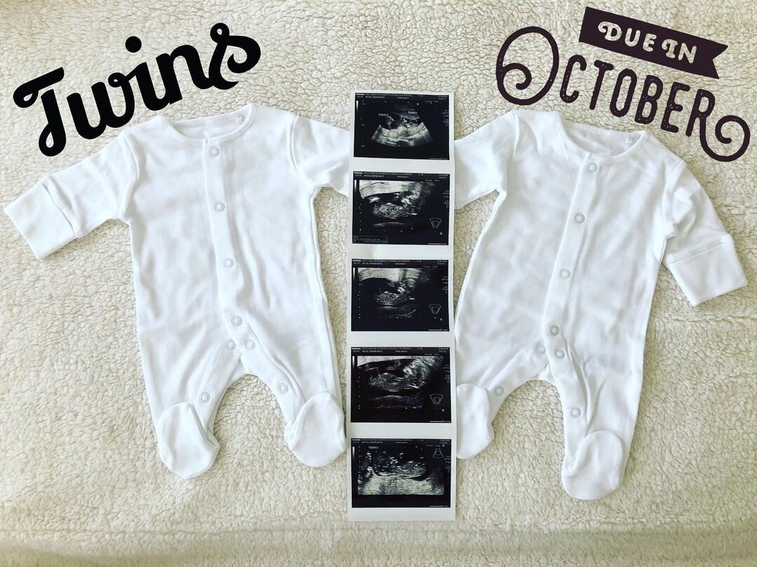 УЗИ в 12 недель — стало известно о двойне