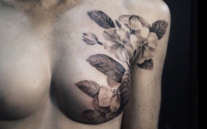 На сегодняшний день пластическая хирургия доступна по системе ОМС и позволяет покалеченным болезнью женщинам получить второй шанс на полноценную жизнь и даже своеобразную красоту. Фото с просторов интернета.