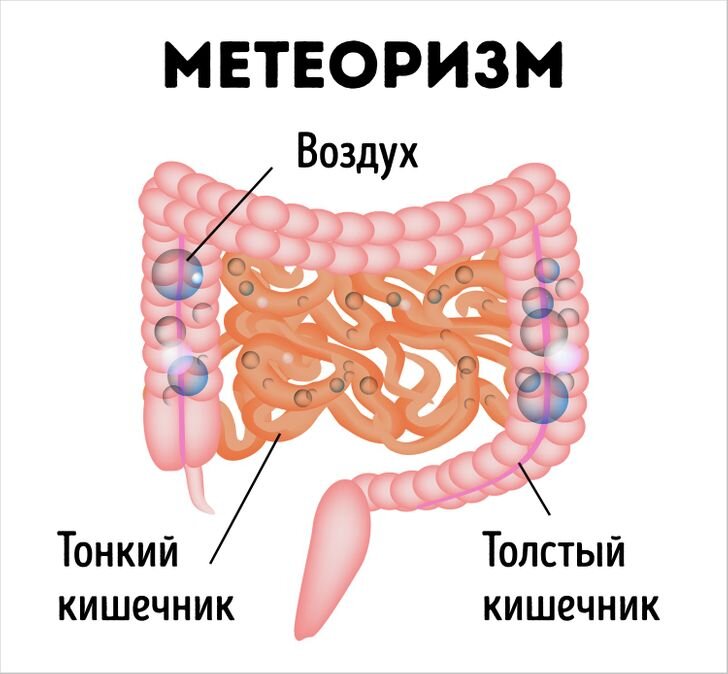 Вздутия спазмы кишечника