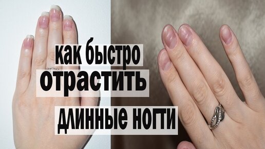 Как ОТРАСТИТЬ ДЛИННЫЕ НОГТИ за 2 дня ? - ПРОВЕРЕННЫЙ СПОСОБ - How to grow long nails in 2 days