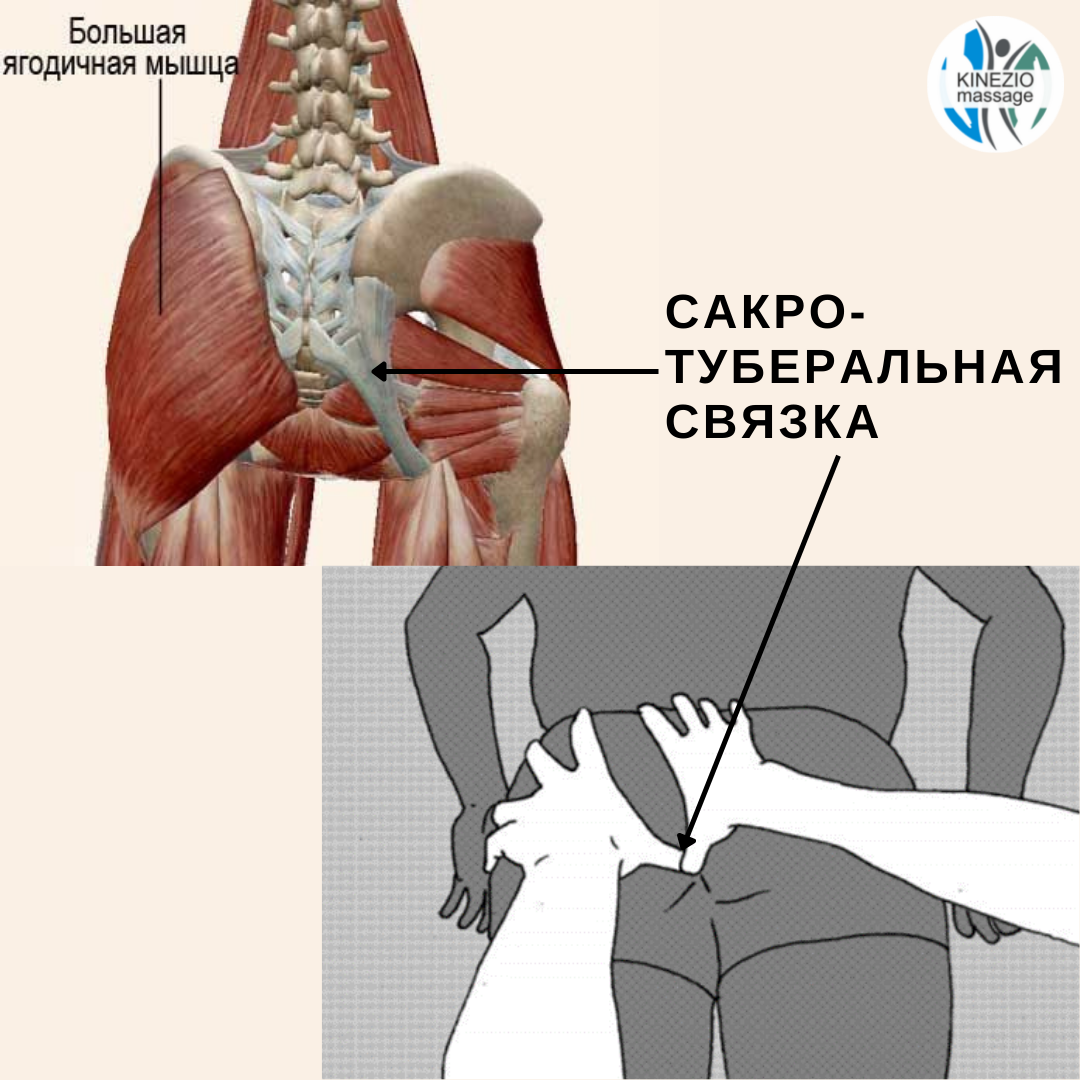 Потянул спину симптомы. Сакротуберальная связка. Сакротуберальная связка где находится. Как найти сакротуберальную связку.