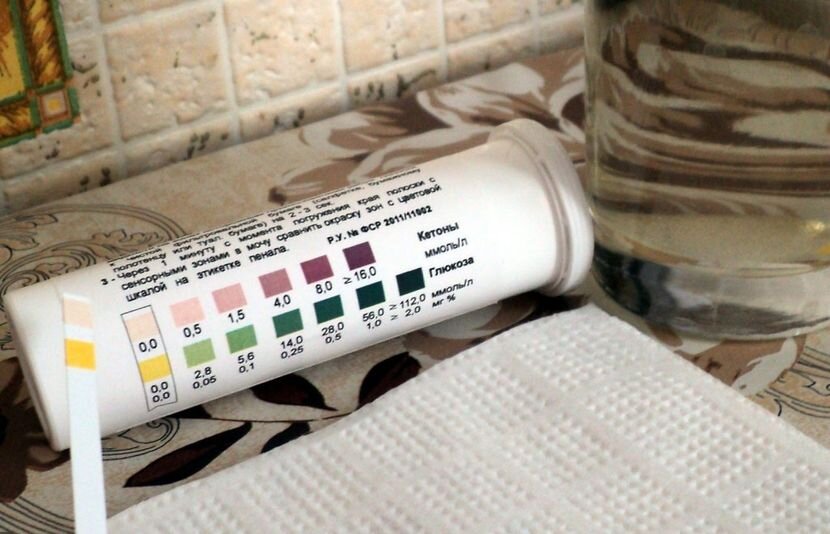 тест полоски на ацетон в моче. ацетонемическая рвота у детей. ацетон в моче у ребенка. повышенный ацетон у ребенка симптомы. повышенный ацетон у ребенка симптомы.