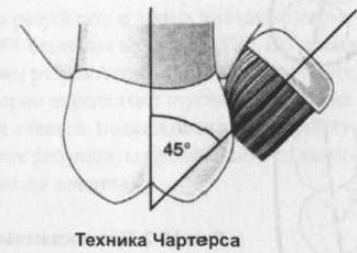 Charters техника