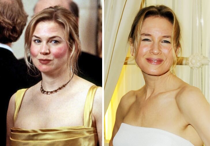 Is Renee Zellweger Fat