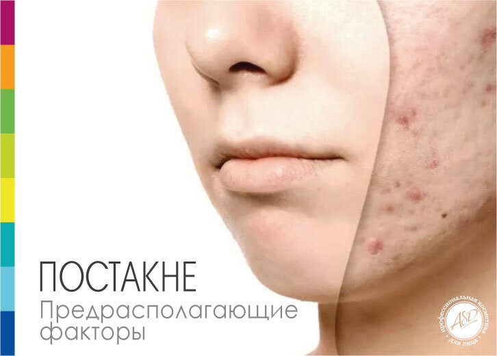 Появление пигментации и рубцов постакне - главная причина психологического дискомфорта и иногда сиуцидальных мыслей. Важно избавиться от косметического дефекта и недопустить его появления в будущем!