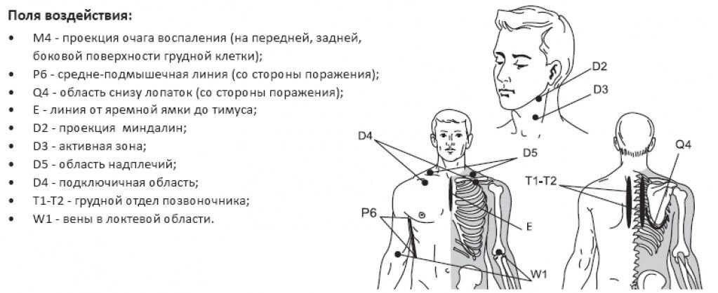 Изображение принадлежит ВНПП "ЖИВА"