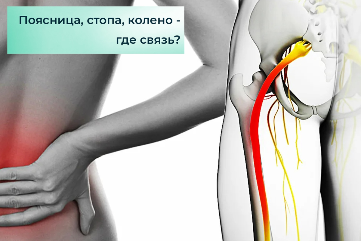 Поясница отдает в колено