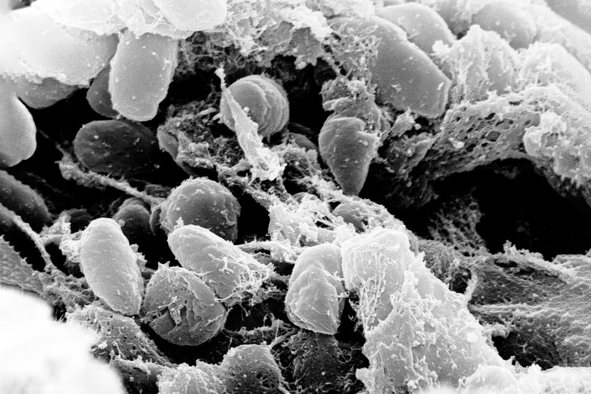 Yersinia pestis, электронная микрофотография