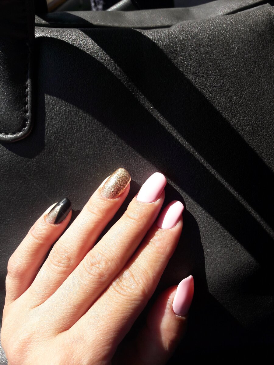 Вот такие суставы через полгода.