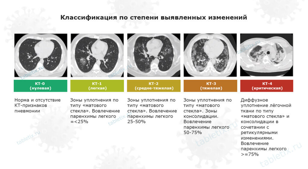 Классификация по степени выявленных на КТ изменений в легких
