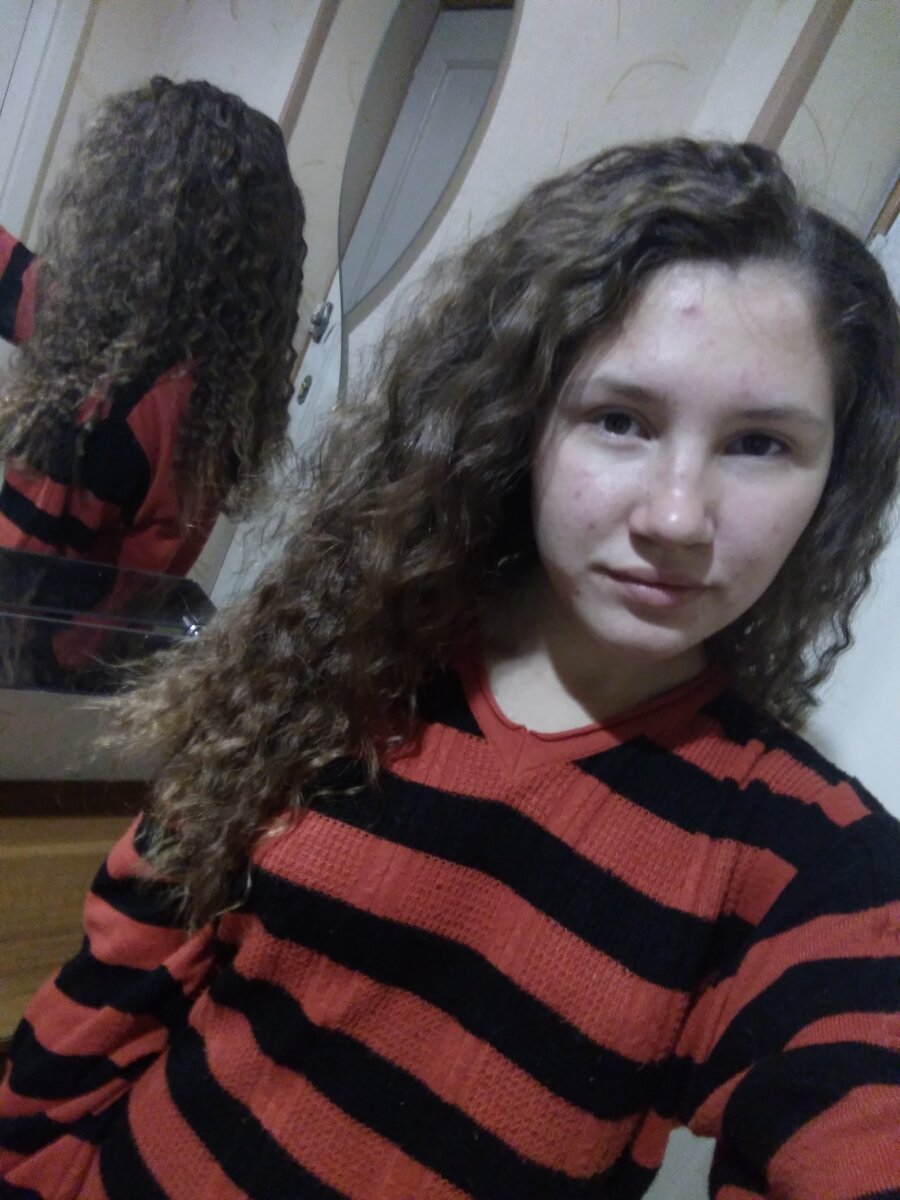 Время, когда я начала хоть как-то бороться с акне