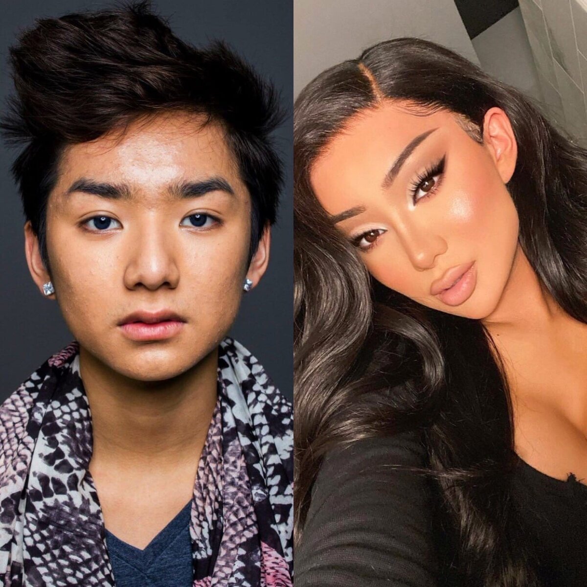 Has nikita dragun had gender reassignment surgery